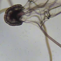 sea star larval form