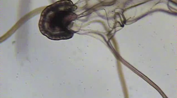 sea star larval form